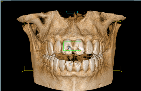 radiografias 3d