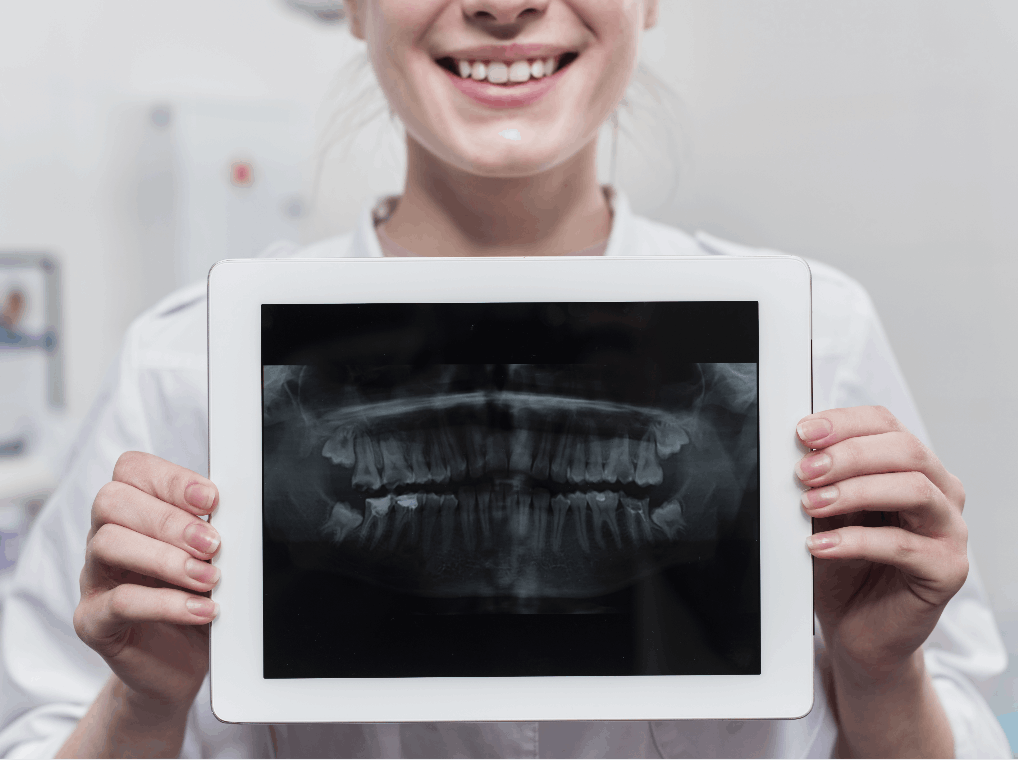 Sonrimax, Radiografías dentales