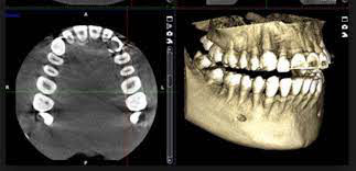 Sonrimax, Radiografías dentales
